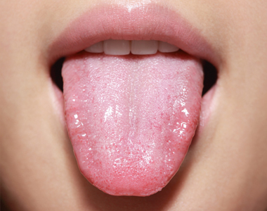 Will cleaning your tongue help reduce the risk of heart disease, arthritis, and other inflammatory diseases?