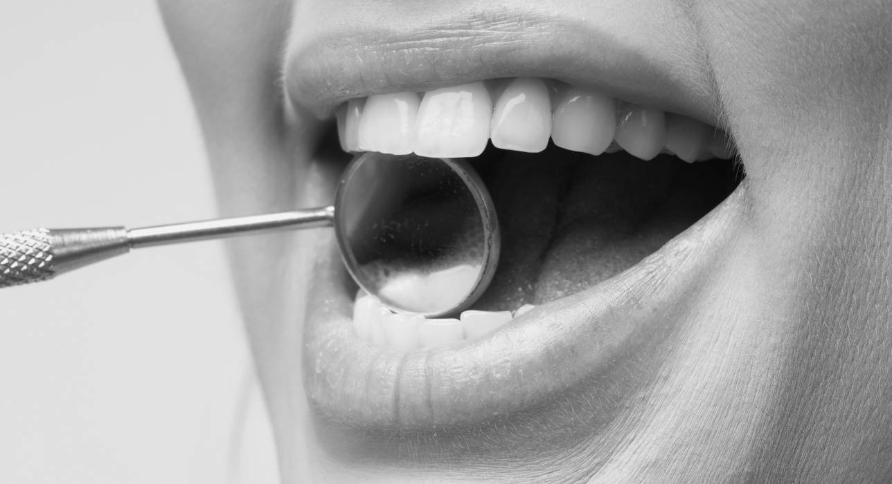 General Dentistry in West Chester