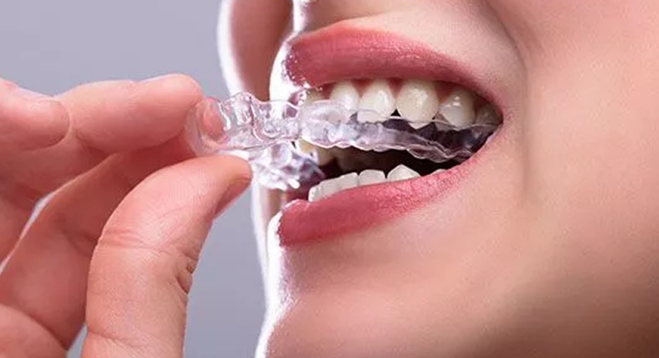 Night Guards West Chester, Ohio