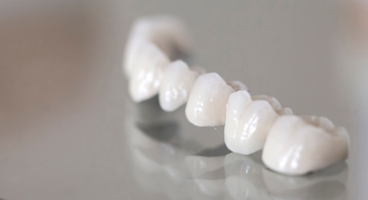 Porcelain crowns in West Chester Ohio