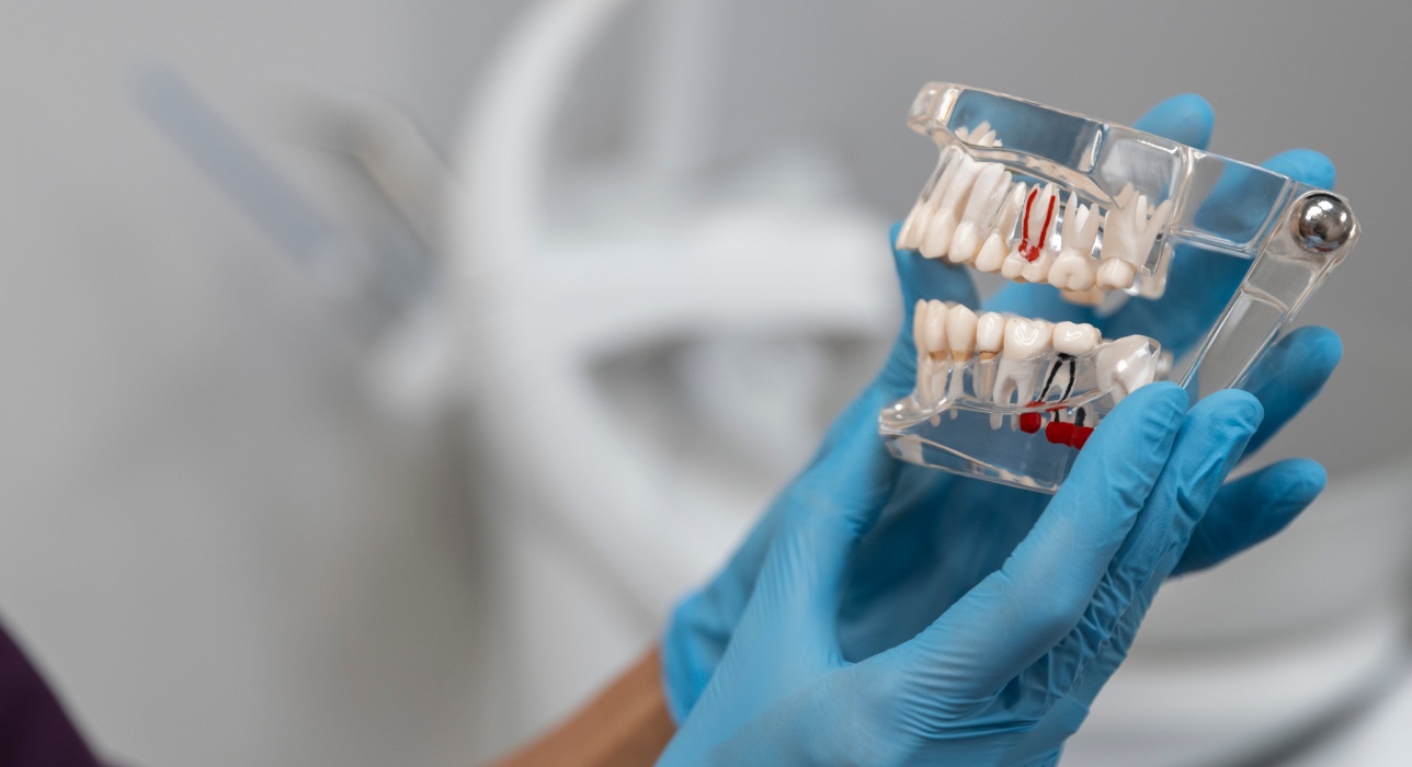 Root Canals Treatment in west Chester, Ohio